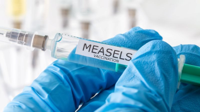 Потвърдените случаи на морбили у нас са вече 137